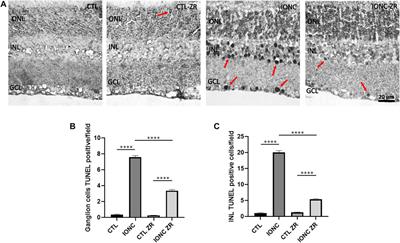 A hypothermia mimetic molecule (zr17-2) reduces ganglion cell death and electroretinogram distortion in a rat model of intraorbital optic nerve crush (IONC)